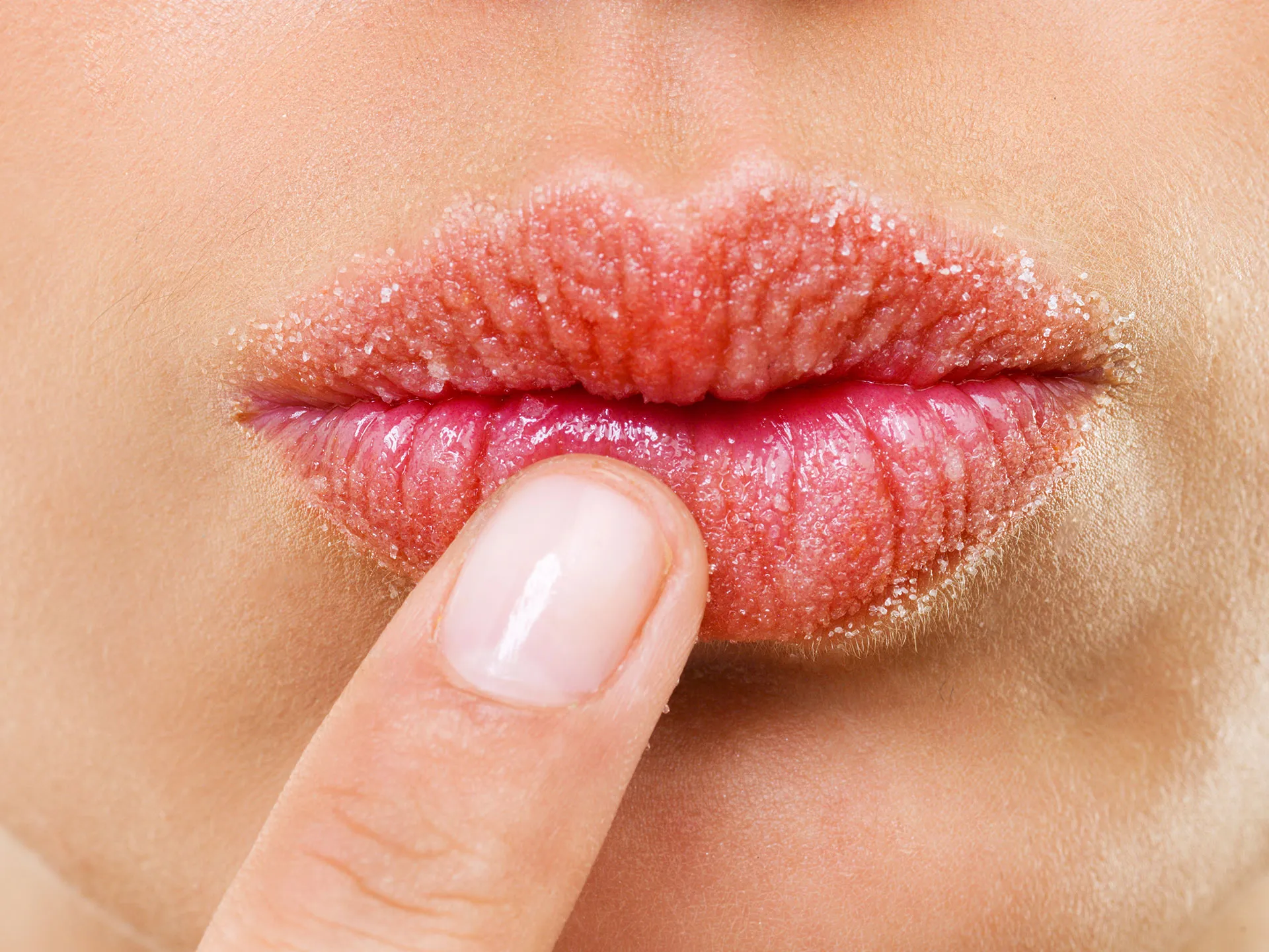 You Don t Have To Suffer With Chapped Lips This Winter Center For 