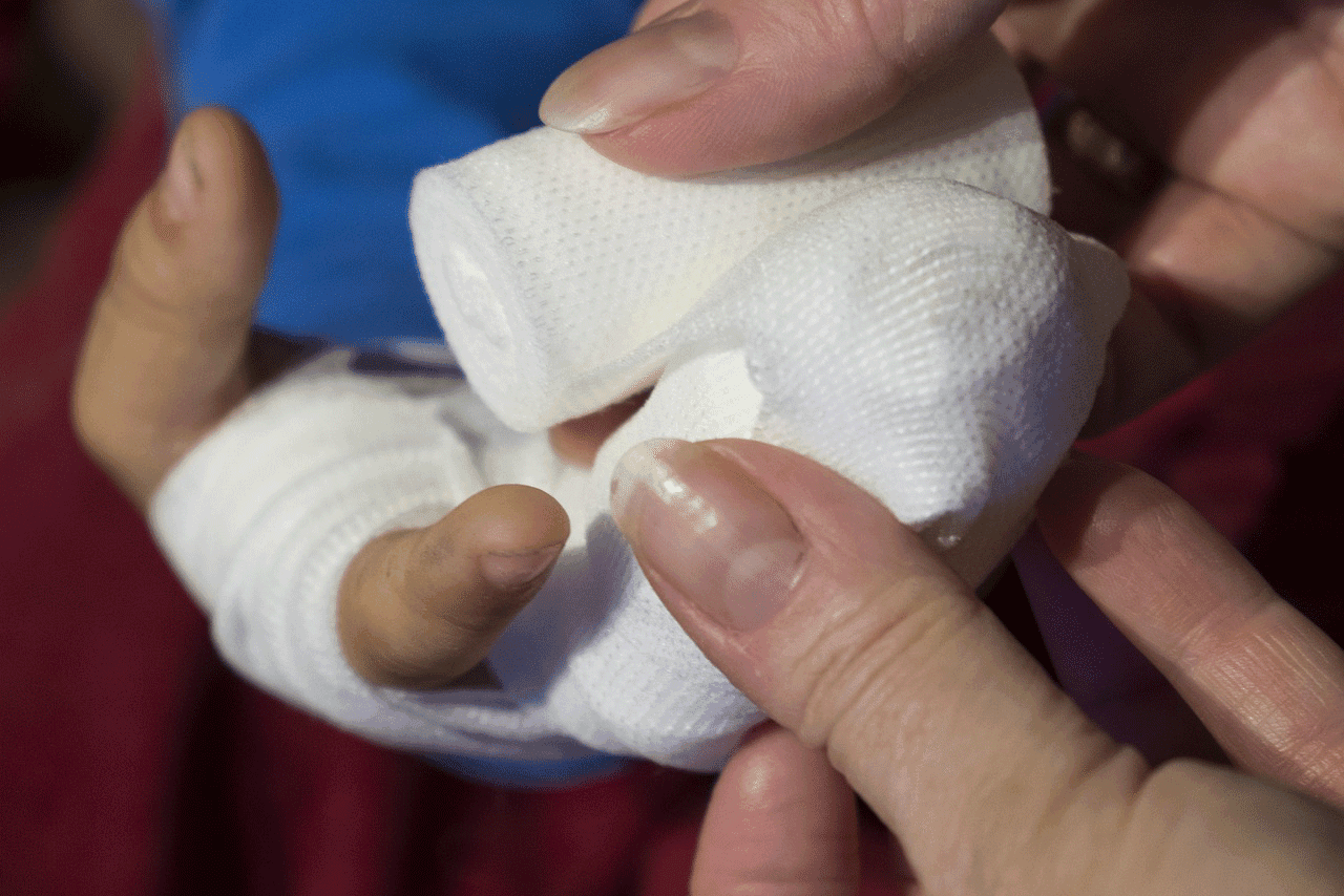 First Aid Basics for Skin Injuries