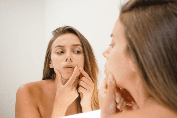 Do Blackheads Mean Your Cleanser Isn’t Working?