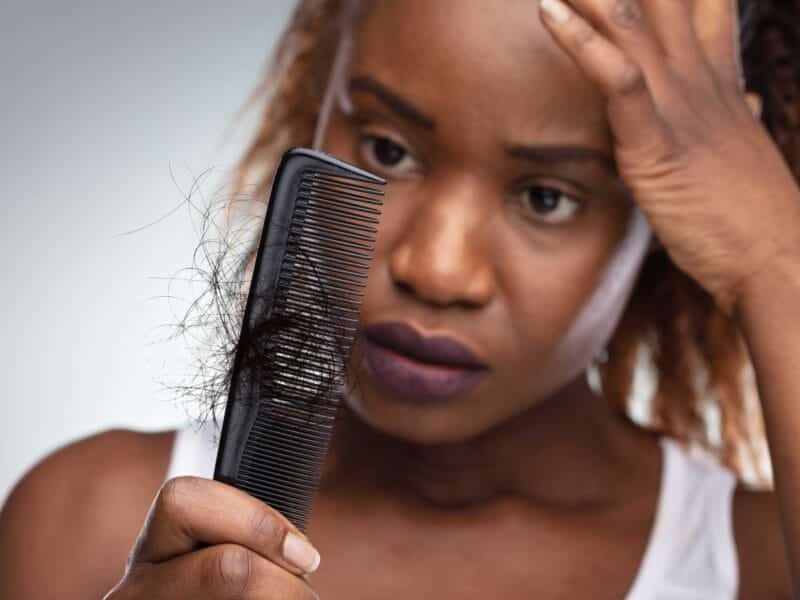 New Treatments Show Promise for Black Patients with Hair Loss