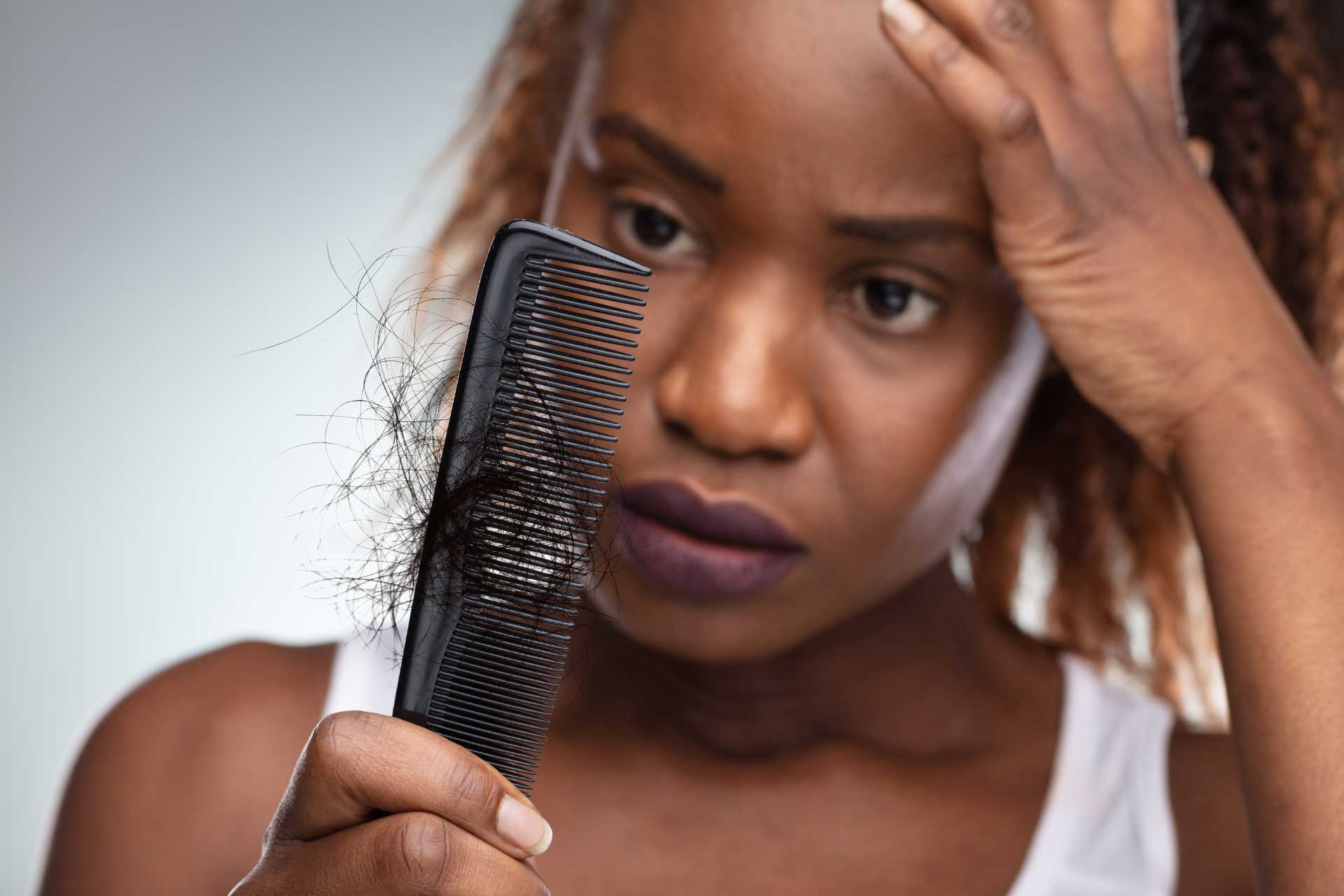 New Treatments Show Promise for Black Patients with Hair Loss