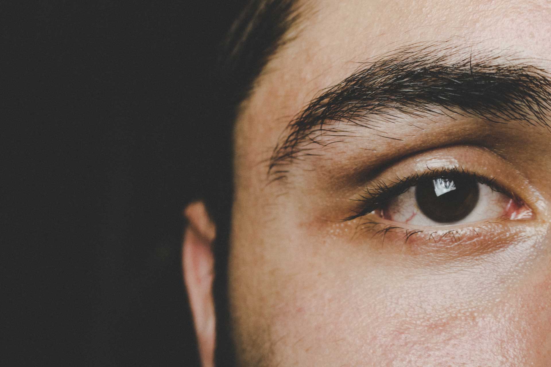 Crow’s Feet and Dark Circles Are on Everyone’s Radar. Preorbital Veins Are Not, But They Should Be