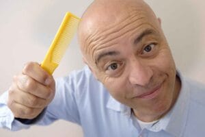 A Bald Head Needs Love, Too