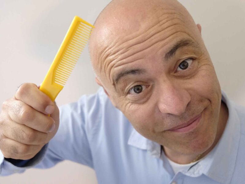 A Bald Head Needs Love, Too