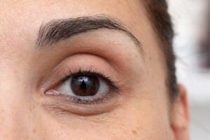 Skincare Products Are Mostly Ineffective at Brightening Dark Circles, but a Dermatologist Can Help