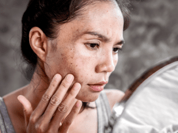Niacinamide, As an Active Ingredient, Deserves Your Consideration. Here’s Why