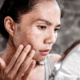 Niacinamide, As an Active Ingredient, Deserves Your Consideration. Here’s Why
