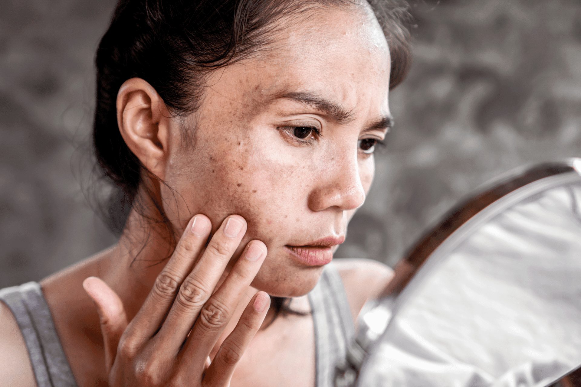 Niacinamide, As an Active Ingredient, Deserves Your Consideration. Here’s Why