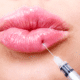 Everything You Need to Know About Filler Migration