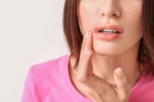 Is It OK to Hide a Cold Sore with Makeup?
