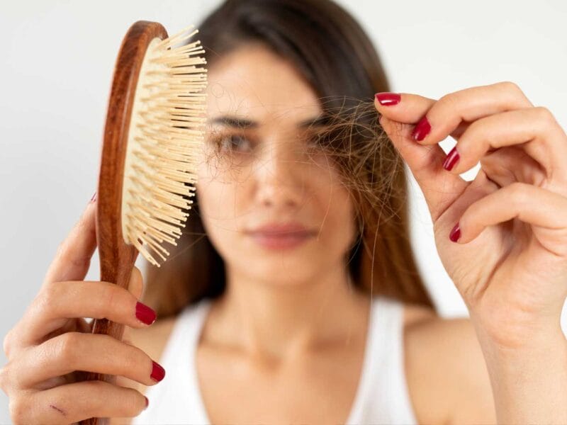 Is Stress-Induced Hair Loss Real?