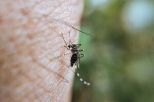 How To Relieve the Itch from A Bug Bite